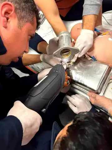 2 Yaşındaki Çocuk Kıyma Makinesinden Kurtarıldı